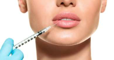 Lip Lift Vs. Lip Filler – What’s Are The Differences