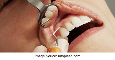 How Do Dental Veneers Help Oral Health