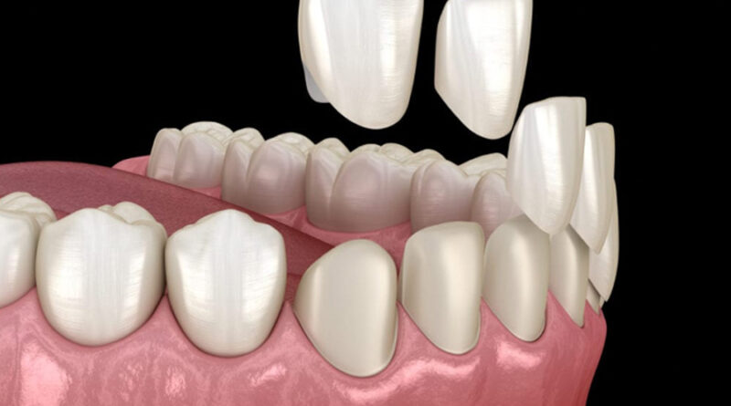 How Is the Treatment of Coated Tooth Infection