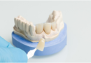 Exploring Different Materials for Tooth Crowns: Choosing the Right Option for You