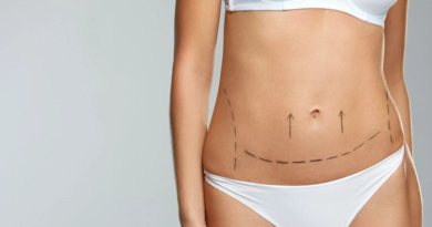 Liposuction in Qatar: A Comprehensive Guide to the Procedure and What to Expect