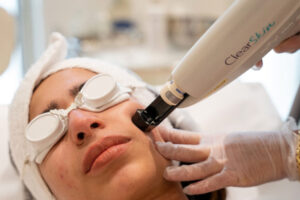 Reveal Radiance and Confidence with the Power of Alma Lasers in Broadmeadows