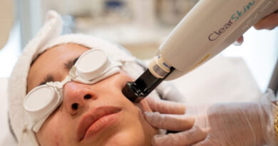 Reveal Radiance and Confidence with the Power of Alma Lasers in Broadmeadows