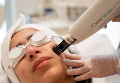 Reveal Radiance and Confidence with the Power of Alma Lasers in Broadmeadows