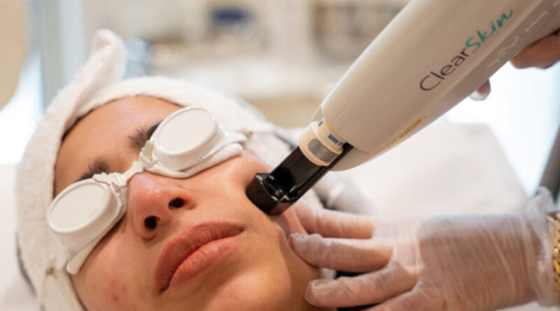 Reveal Radiance and Confidence with the Power of Alma Lasers in Broadmeadows