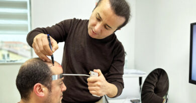 Why Choose Dr.Resul Yaman Hair Clinic for Hair Transplant Turkey?